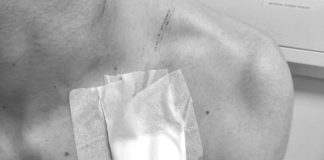 Homem com mandado de prisão leva facada e acaba preso em Concórdia