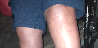 Homem é preso por agredir a própria mãe, danificar viatura e desacato em Concórdia