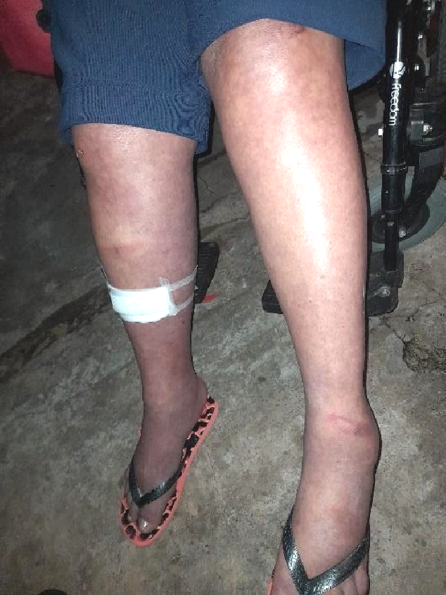 Homem é preso por agredir a própria mãe, danificar viatura e desacato em Concórdia